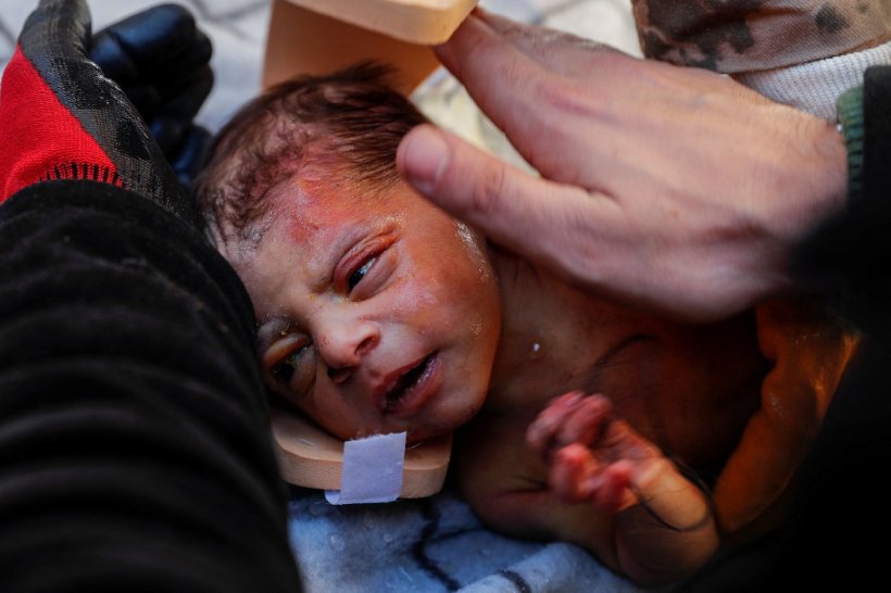 20 günlük mucize bebek Kerem 60 saat sonra kurtarıldı