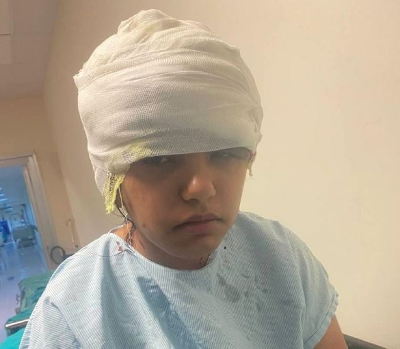 Alanya'da Go-kart dehşeti: Genç kızın kafa derisi