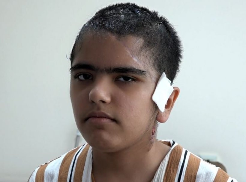 Alanya'da Go-kart dehşeti: Genç kızın kafa derisi