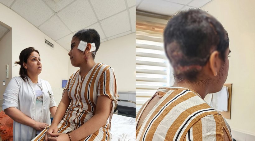 Alanya'da Go-kart dehşeti: Genç kızın kafa derisi