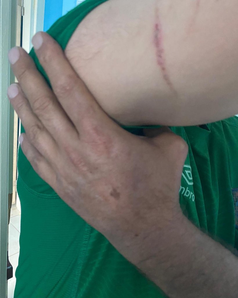Kestelspor'a Siirt'te çirkin saldırı: Jilet, muşta demir sopa
