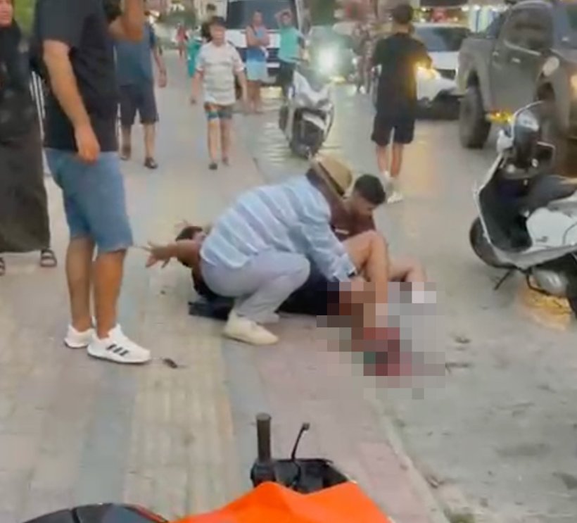 Alanya'da motosiklet kazası:  Bir gencin bacağı koptu