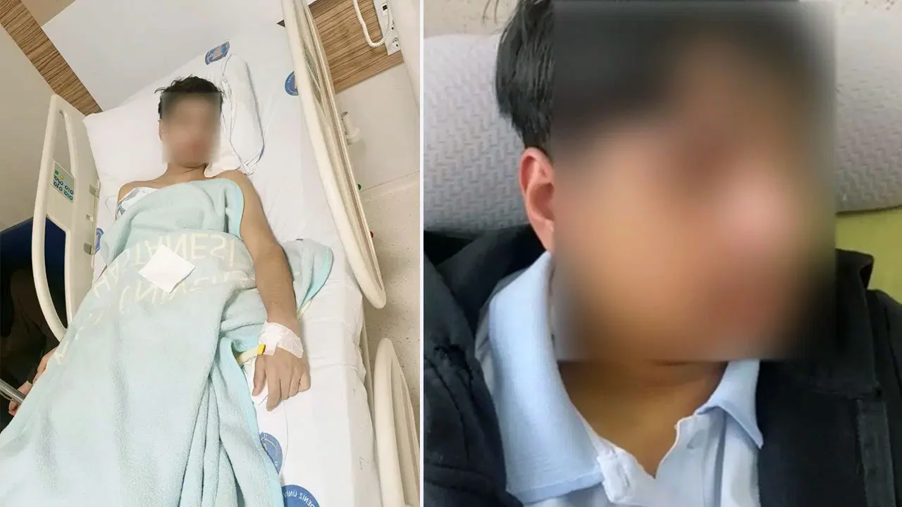 Antalya'da Okulda Dehşet: Çenesini İki Yerden Kırdılar, 5 Gün Cezayla Kurtuldular!